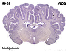 Brain section image
