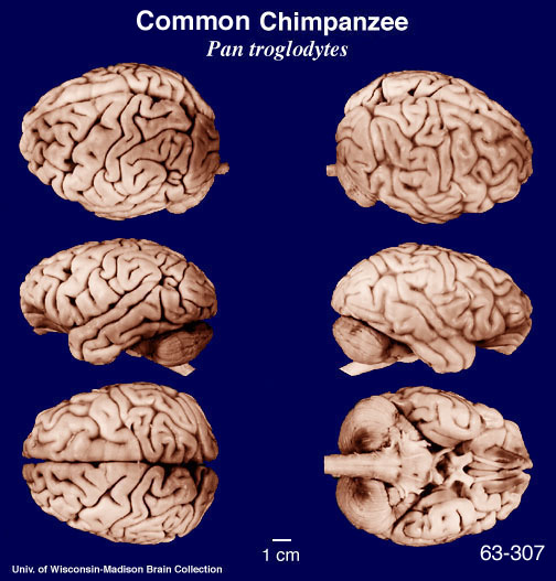 http://brainmuseum.org/Specimens/primates/chimp/brain/chimp6sect6.jpg