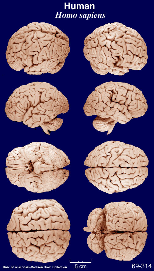 Macaque Brain