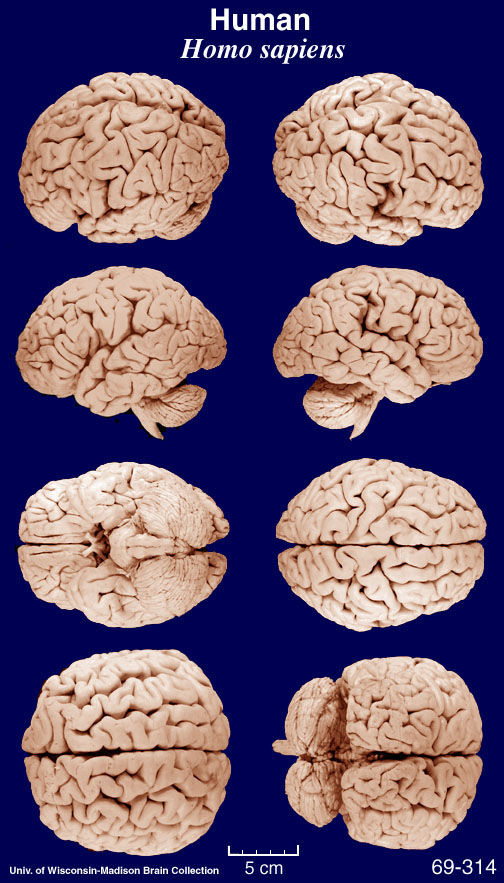 Mammalian Brain Development