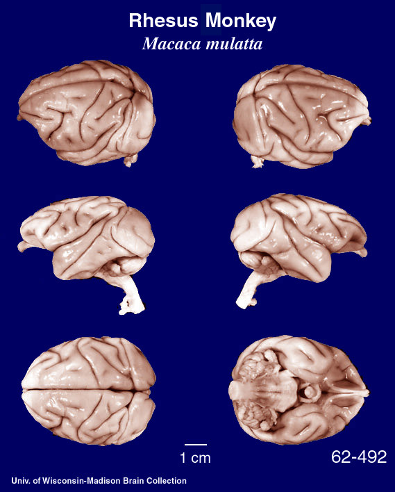 http://brainmuseum.org/Specimens/primates/rhesusmonkey/brain/Rhesusmonk6.jpg