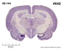 Brain section image