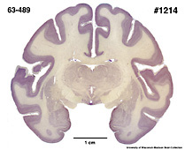 Brain section image