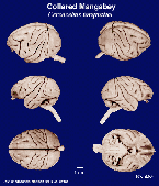 Whole brain image