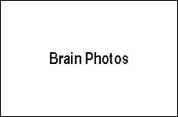 Whole brain image